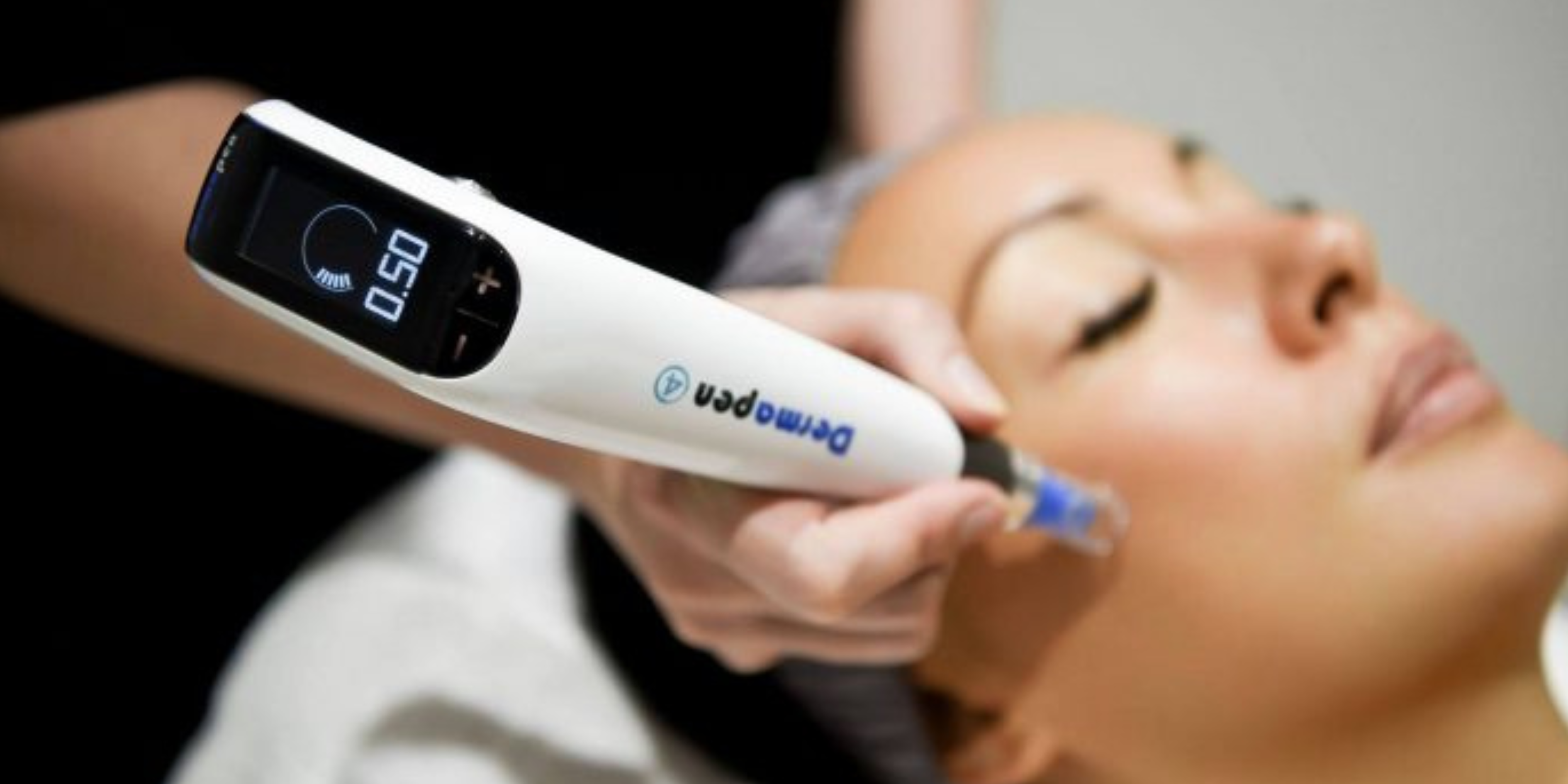 Dermapen4 tratamiento