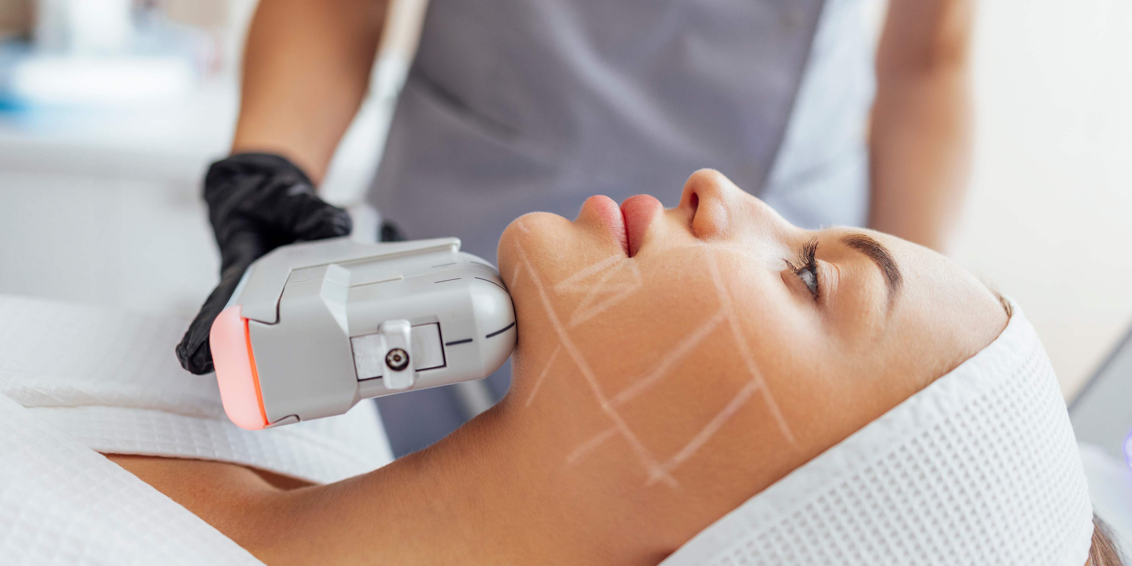 Tratamiento HIFU 12D lifting no quirúrgico