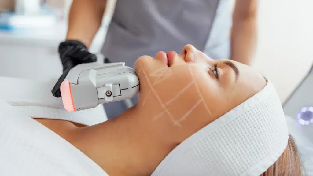 HIFU facial y cuello